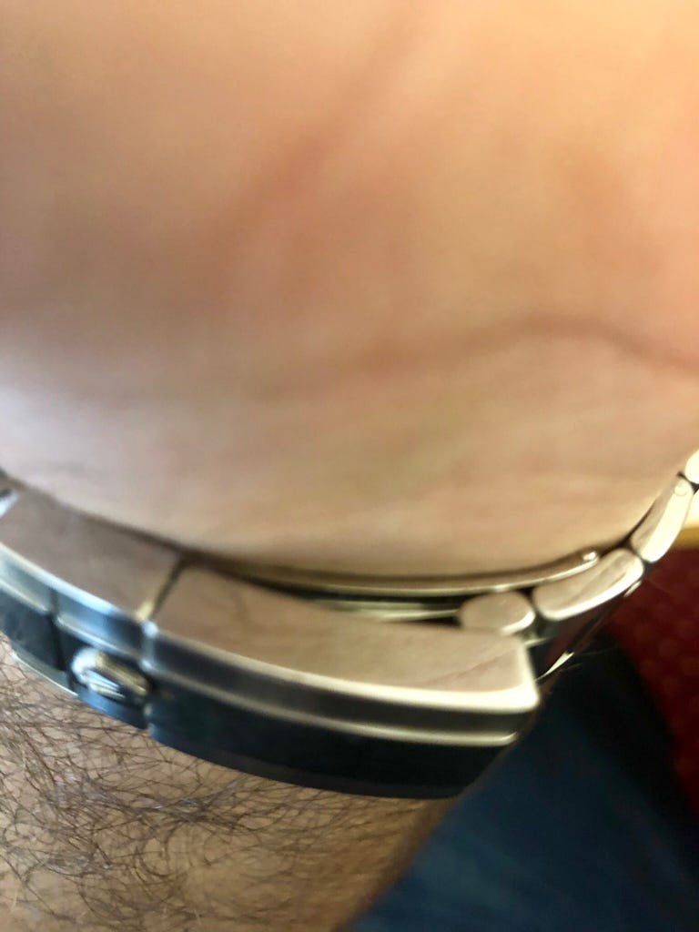 Watch Cannot Close Clasp Not Closing Properly | WatchUSeek Watch Forums