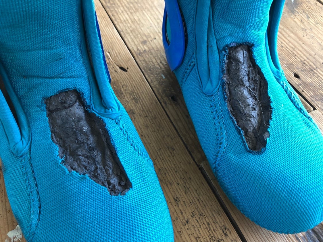 Foot burn, foot pain, pins and needles when wearing snowboarding boots